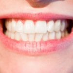 Mocne i zdrowe zęby bez próchnicy – zadbaj o nie już dziś. Próchnica – leczenie oraz profilaktyka